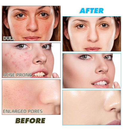 120 Pads Kojic Acid and Turmeric Cleansing Pads,Turmeric Cleansing Pads Balance Skin Oil and Water,Gentle & Non-Irritating,For Body'S Skin